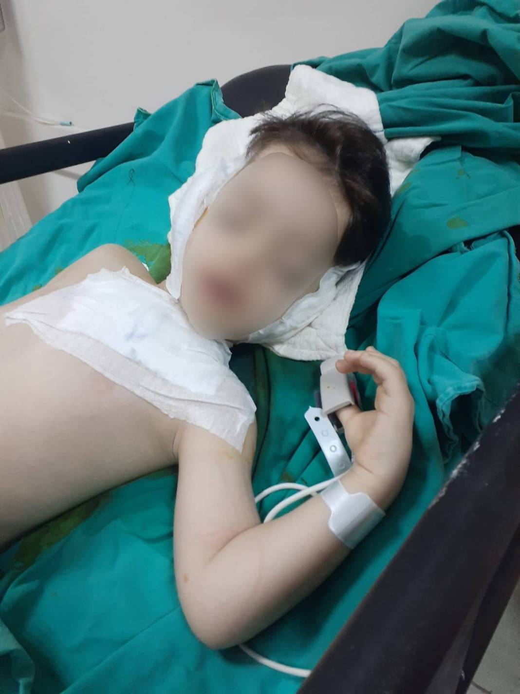 Ameliyat olan 4 yaşındaki çocuğun kulağı çürüdü! 'Operasyonlar güzel geçti diye bizi oyaladılar' 7